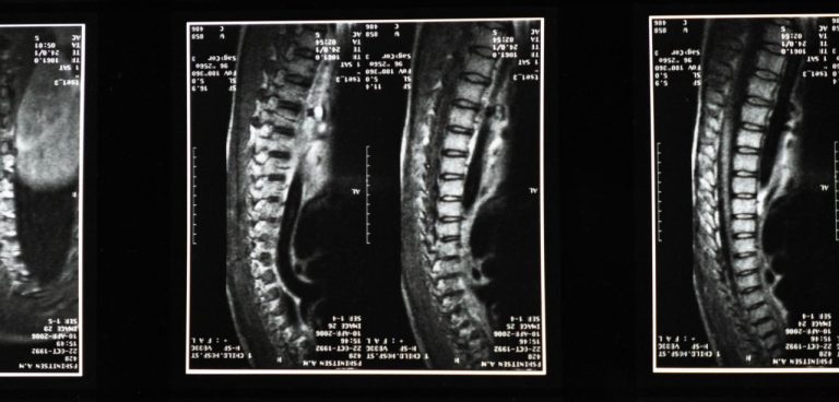 UPDATE XL-AXIS EDU XRAY.hc Hari Ini