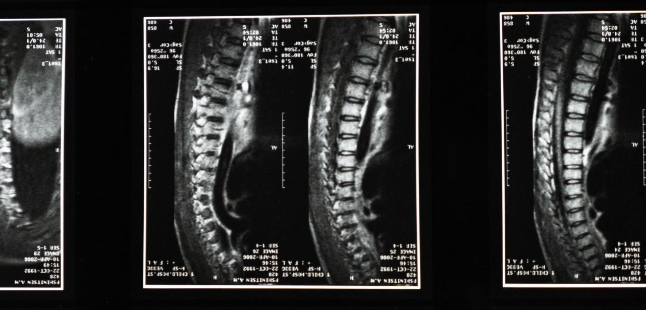 XL-AXIS EDU XRAY.hc